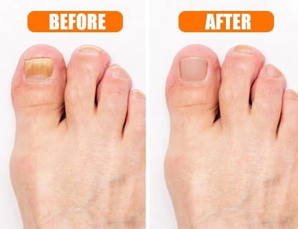 Welnax BioClear 10